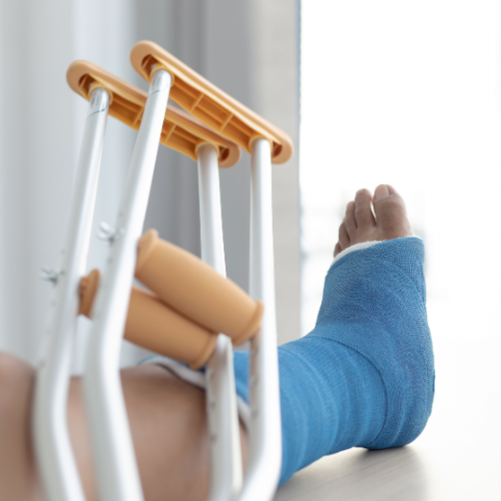 Ways to Prepare for Foot Surgery